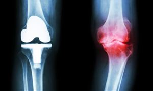 九游娱乐平台：2024年中国冶金矿山机械行业的市场发展现状及发展前景(图5)